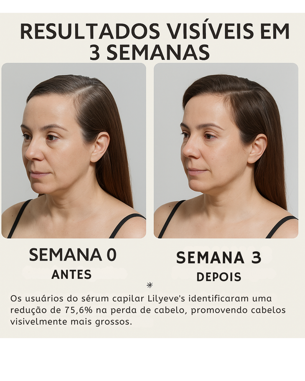 Lilyeve Hair Grow Care Serum Anti Queda de Cabelo com Exossomos Ampola 100ml Coreana
