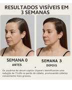 Lilyeve Hair Grow Care Serum Anti Queda de Cabelo com Exossomos Ampola 100ml Coreana
