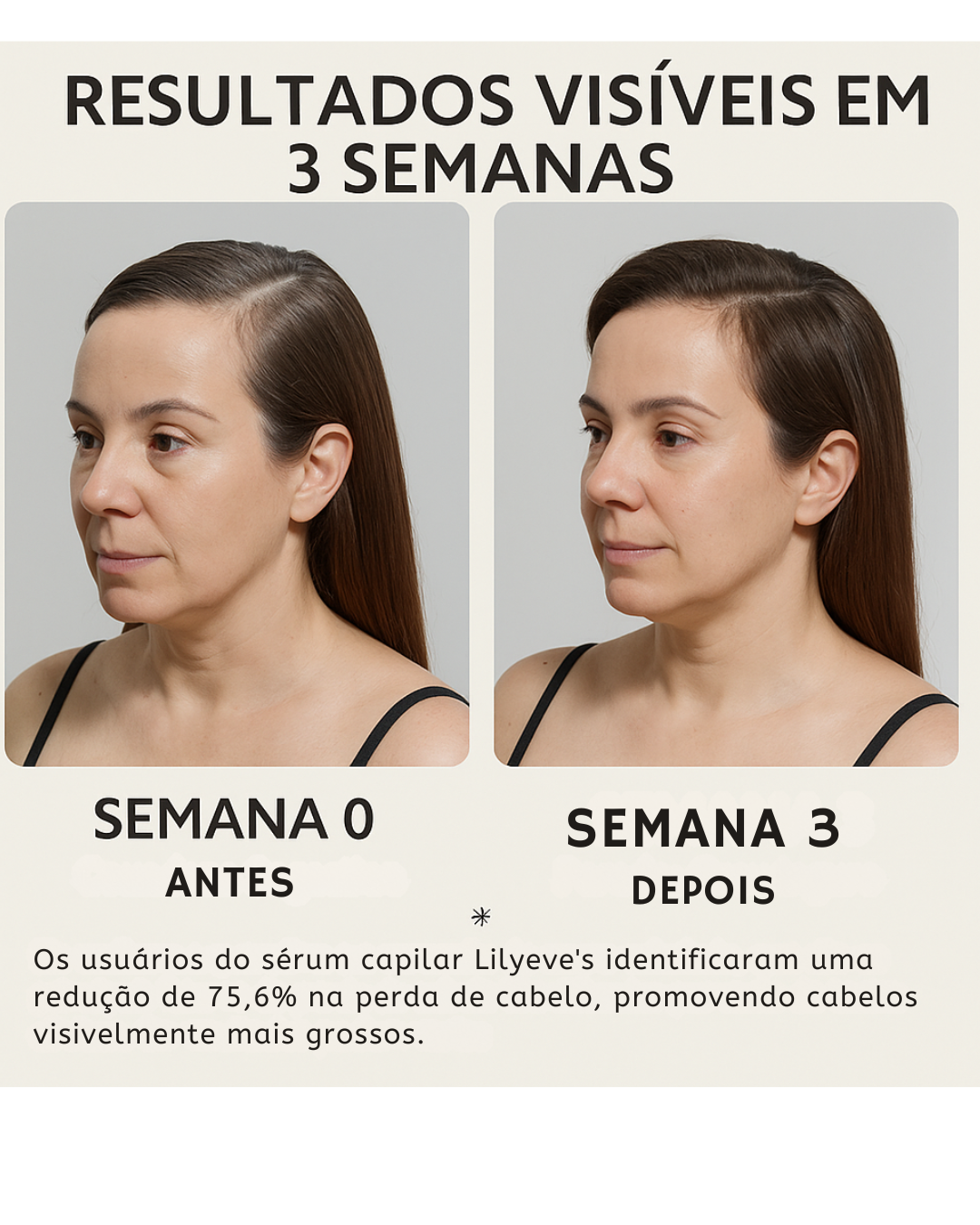 Lilyeve Hair Grow Care Serum Anti Queda de Cabelo com Exossomos Ampola 100ml Coreana
