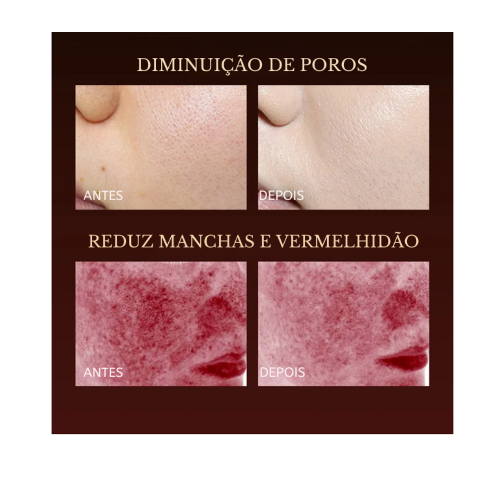 Máscara Facial LED Terapia Photon High 7 Cores em Silicone com 110 Leds - Anti Sinais