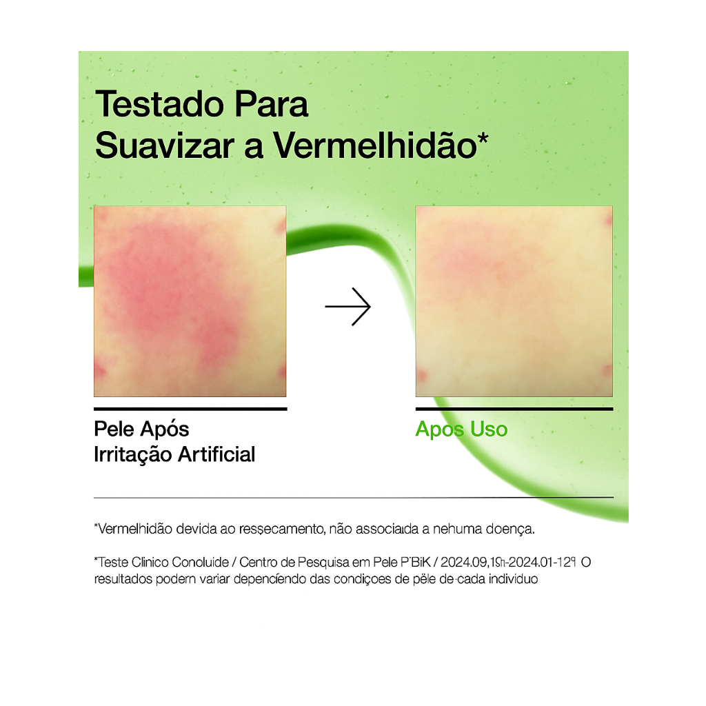 Sérum Ácido Azelaico 10% ANUA – Anti-Vermelhidão, Calmante Ação Anti Acne