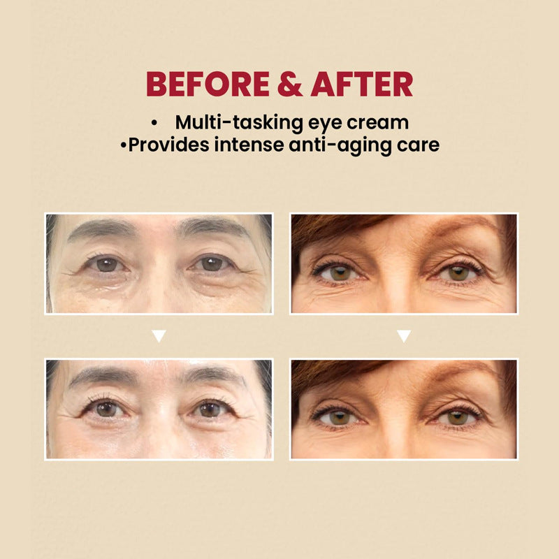 Creme para Área dos Olhos SEOUL 1988  com Retinal 4% Com Peptídeos e Bakuchiol - Ação Anti Sinais e Firmeza