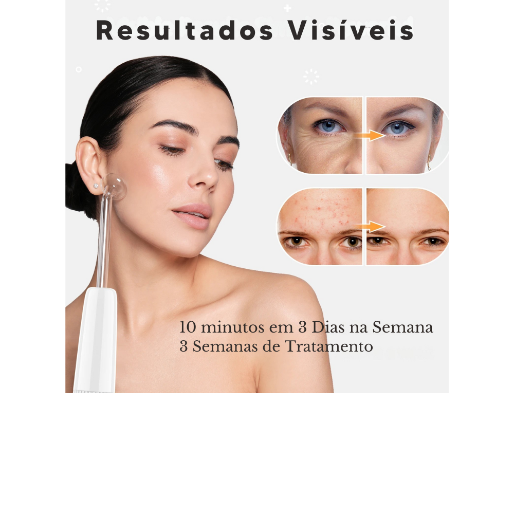 Aparelho de Alta Frequência DARSONVAL- 6 em 1, Terapia Facial Anti Sinais, Acne e Cabelo