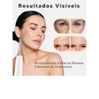 Aparelho de Alta Frequência DARSONVAL- 6 em 1, Terapia Facial Anti Sinais, Acne e Cabelo