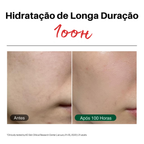 Dr G Red Blemish Hidratante Facial Calmante para Peles Sensíveis, Acneicas e Irritadas