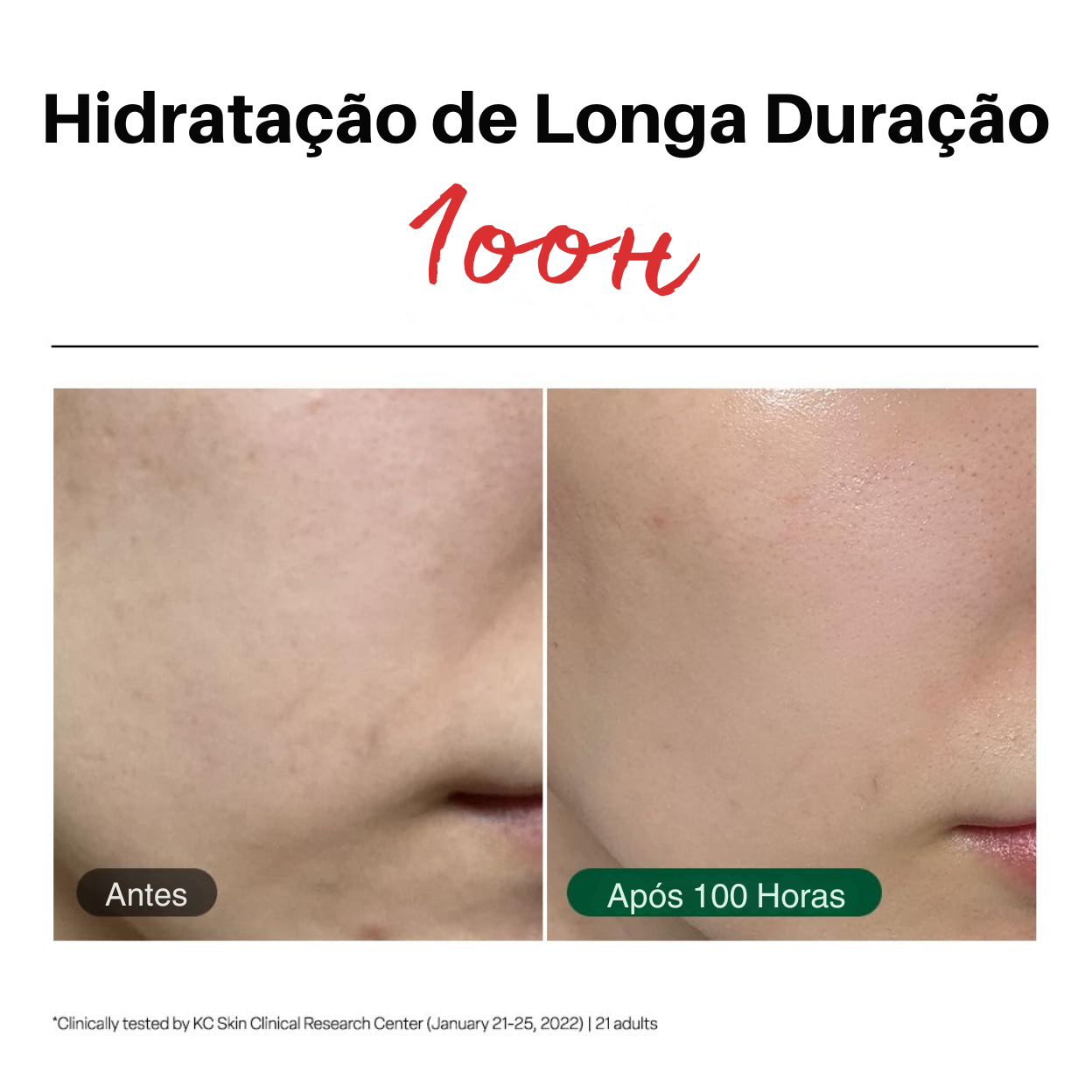 Dr G Red Blemish Hidratante Facial Calmante para Peles Sensíveis, Acneicas e Irritadas