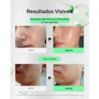 VT COSMETICS CICA Reedle Shot 700 - Sérum de Microagulhamento em Creme com Espículas e Exossomos