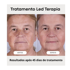 Máscara Facial LED Terapia Photon High 7 Cores em Silicone com 110 Leds - Anti Sinais