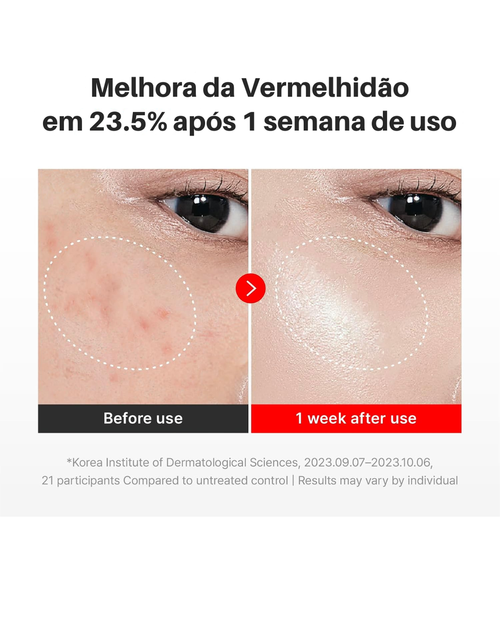 Creme Rejuvenescedor CENTELLIAN 24 Madeca Time Reverse Efeito Lifting  - Nutre, Hidrata, Firma