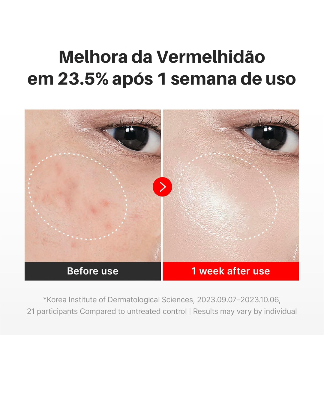 Creme Rejuvenescedor CENTELLIAN 24 Madeca Time Reverse Efeito Lifting  - Nutre, Hidrata, Firma