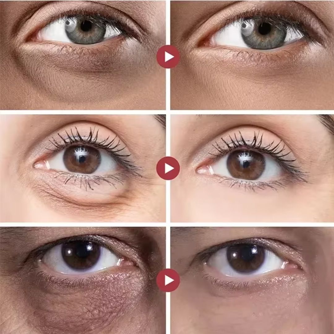 Rolon 5 em 1 Ultra Rejuvenescedor - Luteína Glow®